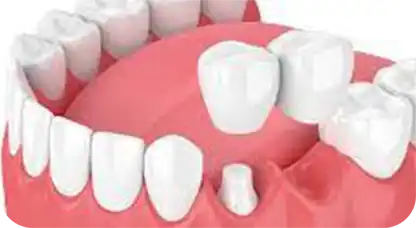 glamyo-dental